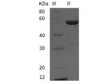 Recombinant Rat cyclin A2/CCNA2 protein (His tag)