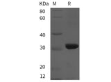 Recombinant Rat CD38/ADPRC1 protein (His tag)