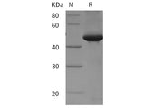 Recombinant Rat TGF-beta 3/TGFB3 protein (His tag)