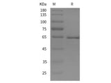 Recombinant Rat FGG/Fibrinogen gamma chain protein (His tag)