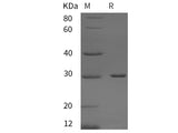 Recombinant Rat GSTM2 protein (His tag)