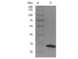 Recombinant Rat ST14/Matriptase protein (His tag)