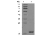 Recombinant Rat IL1A/IL-1F1 protein (His tag)