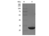 Recombinant Rat CD146/MCAM protein (His tag)