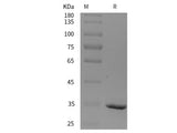 Recombinant Rat CD109 protein (His tag)