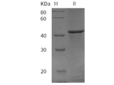 Recombinant rat Prostatic Acid Phosphatase/ACPP protein (His tag)