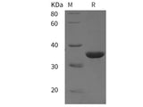 Recombinant Rat IGFBP1/IGFBP-1 protein (His tag)