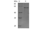 Recombinant rat IL7R/IL-7R/CD127 protein (His tag)