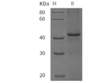 Recombinant Rat CD5 / Cluster of Differentiation 5 protein (His tag)