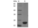 Recombinant Rat CD47 protein (His tag)