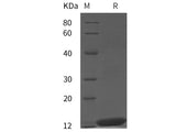 Recombinant Monkeypox virus MPXV（A29L） protein (His tag)