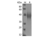 Recombinant Human TIM-3/HAVCR2 Protein (His Tag)