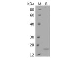 Recombinant Human Interferon α-1/IFNA1 Protein (His Tag)