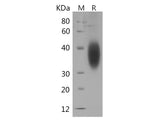 Recombinant Human B7-H5/Gi24/VSIR Protein (His Tag)