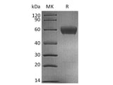 Recombinant Human CD47/IAP Protein (mFc Tag)