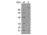 Recombinant Human SIGLEC2/CD22 Protein (His Tag)