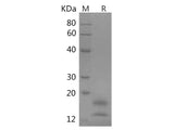 Recombinant Human VEGF121 protein(His tag)