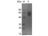 Recombinant Human MICA protein(His tag)