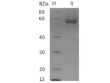 Recombinant Human Glypican-1/GPC1 protein (His tag)