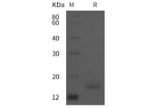 Recombinant Human TNF-α protein (His tag)