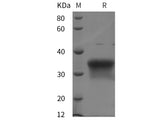 Recombinant Human Oncostatin M/OSM protein (His tag)