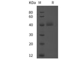 Recombinant Human IgG3 Fc protein (His tag)