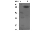 Recombinant Human Calnexin/CANX protein (His tag)