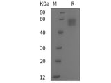 Recombinant Human NPTX2 protein (His tag)