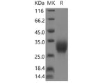 Recombinant Human IL-19 protein (His tag)