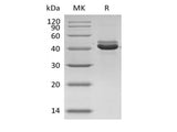 Recombinant Human CD5L/hAIM protein (His tag)