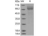 Recombinant Human GP4/CD36 protein (His tag)