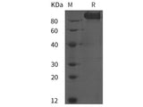 Recombinant Human VEGFR-2/KDR protein (His tag)