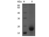 Recombinant Human CD59 protein (His tag)