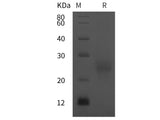 Recombinant HumanFSHa/CGA protein (His tag)