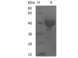 Recombinant Human Tissue Factor/CD142 protein (His tag)