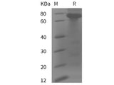 Recombinant Human CHGA protein (His tag)