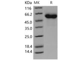 Recombinant Human Complement Factor H/CFH protein (His tag)