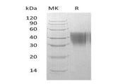 Recombinant Human ORM2 protein (His tag)