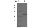 Recombinant Human IgG4-Fc protein (His tag)