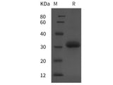 Recombinant Human IGFBP-7 protein (His tag)