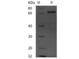 Recombinant Human Alpha-Fetoprotein/AFP protein (His tag)