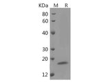 Recombinant Human Interleukin-4/IL-4 protein (His tag)