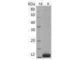 Recombinant Human IL-2 protein (His tag)