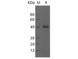 Recombinant Human NECTIN4/Nectin 4 protein (His tag)