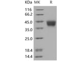 Recombinant Human CD200 protein (His tag)