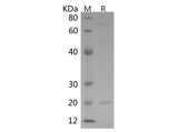 Recombinant Human CTLA-4/CD152 protein (His tag)