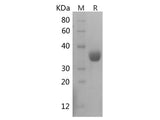 Recombinant Human PDL1/CD274 protein (His tag)