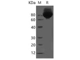 Recombinant Mouse VCAM-1 protein(His tag)