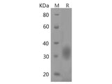 Recombinant Mouse LSH-A protein(His tag)