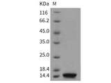 Recombinant Mouse B2M/Beta-2-microglobulin Protein (His Tag)